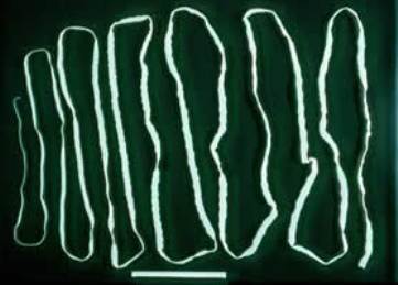 This picture of a full grown adult Taenia saginata shows how long these tapeworms can grow inside a human's intestine. 