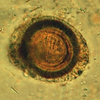 A microscopic view of the Taenia saginata's egg with a thick shell called the oncosphere.