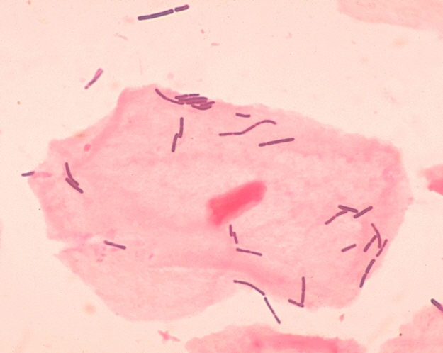 Lactobacillus - Rod Shaped Bacteria