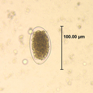 Trichostrongylus