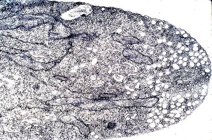 Pores in hyphae Tip