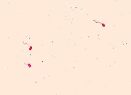 Aeromonas hydrophila. Leifson flagella stain (digitally colorized).