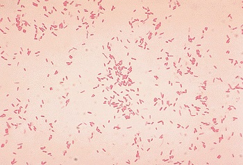 Gram stain of Aeromonas hydrophila