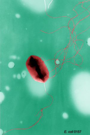 E coli with a flagella. Picture taken from public domain. Taken by E. H. White.