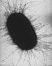 Microscopic picture of E. coli O157. Photo taken from public domain.Taken by Manu Forero. 