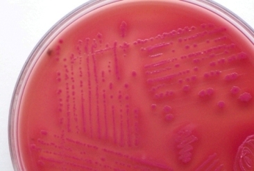 Sample of E. coli O157:H7 (STEC). Photo taken from public domain. Photo taken by Microrao. 