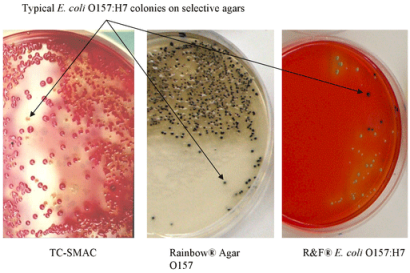 E. coli colonies growing on agar plates. Photo taken from public domain.Photo taken by FDA.