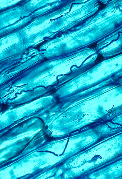 A microscopic image of plant cells with fungal hyphae inside them