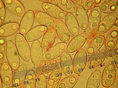 Spores of Gyromitra esculenta showing their ellipse shape and two oil droplets