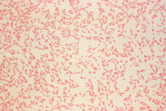 A photomicrograph of Yersinia enterocolitica using gram stain technique. (gram negative)