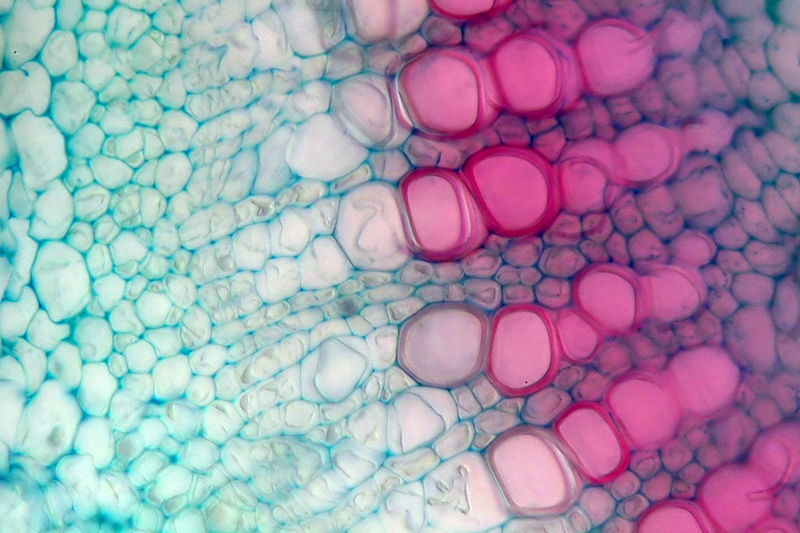 Picture of cross-section xylem and phloem