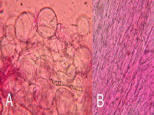 sphaerocysts of Russula on the left, hyphae of a regular mushroom on the right