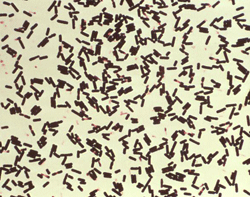 Gram stain of Clostridium Perfringens 