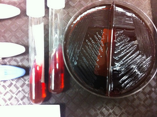 Shigella being tested (Permission Granted)