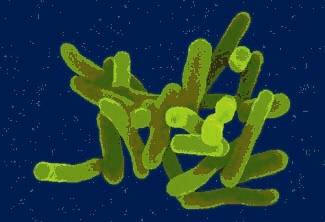 Microscopic picture of Shigella sonnei (Public Domain)
