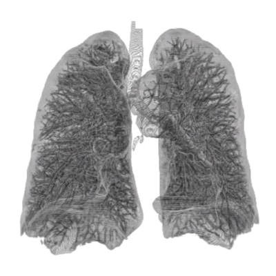 CT image of human lungs