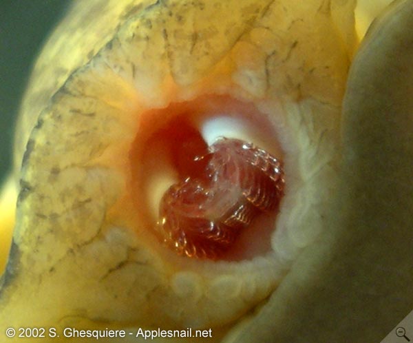 From:  http://www.applesnail.net/content/anatomy/digestion.php This is an image of a radula of a snail used to scrap food into its mouth. 
